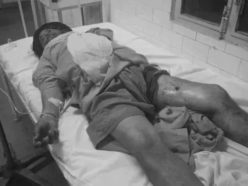 Amritsar firing case