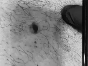 Gurugram firing case,