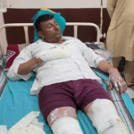 फतेहाबाद में तेज धमाके के साथ घर में लगी आग, चाय बनाने के दौरान हादसा; बाप-बेटी झुलसे