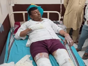 फतेहाबाद में तेज धमाके के साथ घर में लगी आग, चाय बनाने के दौरान हादसा; बाप-बेटी झुलसे