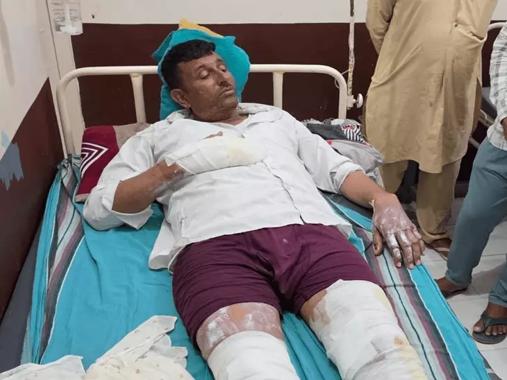 फतेहाबाद में तेज धमाके के साथ घर में लगी आग, चाय बनाने के दौरान हादसा; बाप-बेटी झुलसे