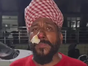 महिलाओं ने ईंट मारकर ई-रिक्शा चालक की तोड़ी नाक:यमुनानगर में किराया मांगने पर पीटा; ₹250 में स्टेशन के लिए बुक किया था
