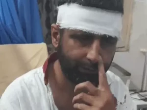 रेवाड़ी में होटल मालिक पर बेसबॉल बैट से हमला, बचाव में आए कर्मचारी पर फेंका खौलता पानी; आरोपी फरार