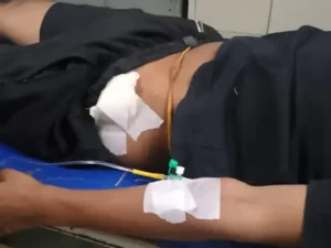 चंडीगढ़ में युवक पर जानलेवा हमला: दुकान से निकलते ही 5 युवकों ने घेरा, पेट में चाकू मारकर फरार