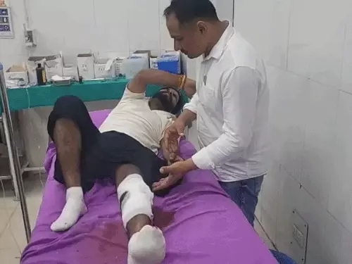 कैथल में आरोपी का एनकाउंटर, टांग में लगी गोली: युवकों पर चाकू से हमला केस में पुलिस कार्रवाई; दूसरा साथी फरार