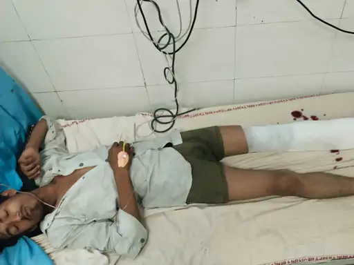 हिसार में पुलिस और बदमाशों के बीच मुठभेड़: CIA टीम पर फायरिंग के बाद जवाबी कार्रवाई, 2 बदमाश घायल